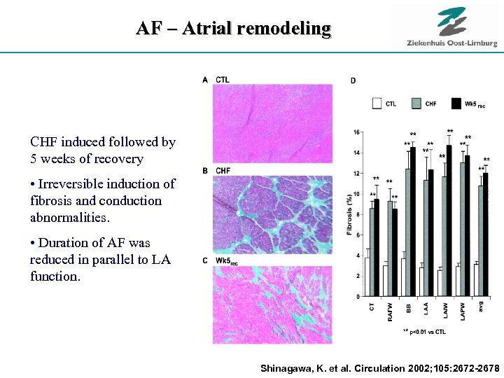 AF – Atrial remodeling CHF induced followed by 5 weeks of recovery • Irreversible