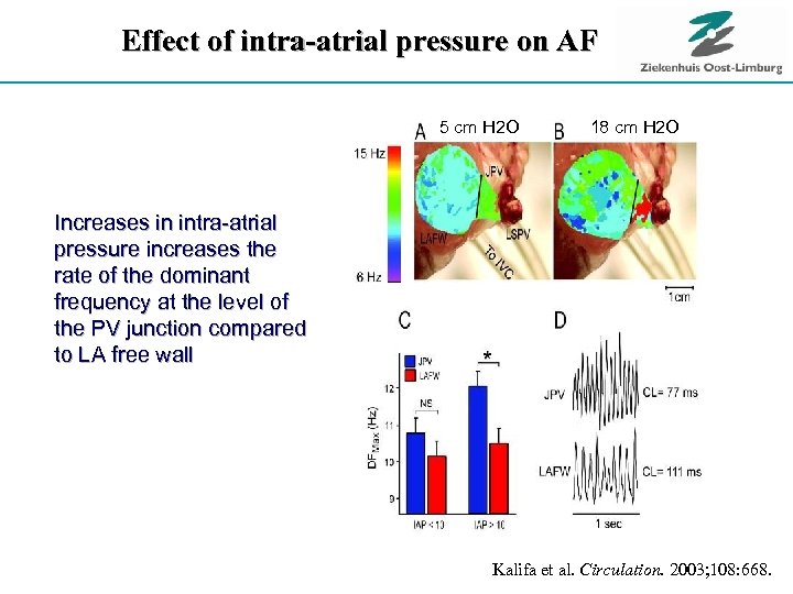 Effect of intra-atrial pressure on AF 5 cm H 2 O 18 cm H