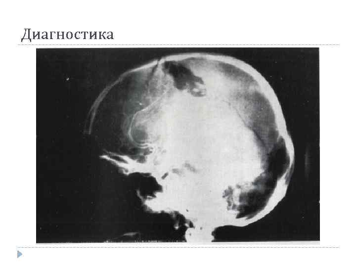 Диагностика 