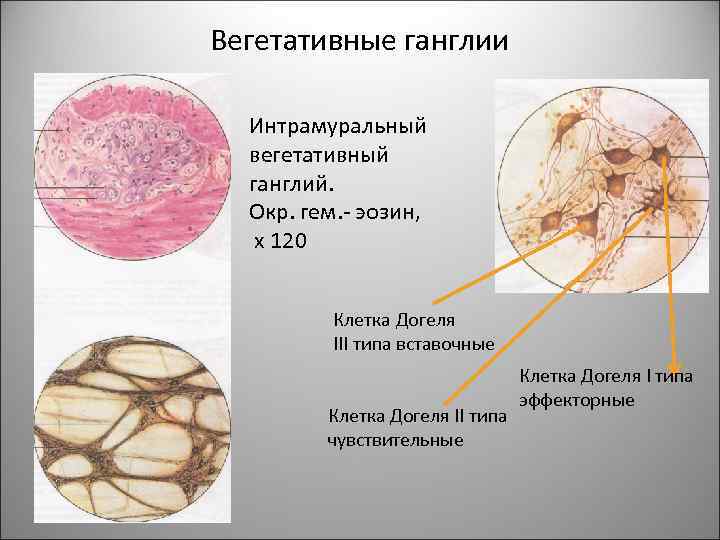 Вегетативные ганглии Интрамуральный вегетативный ганглий. Окр. гем. - эозин, х 120 Клетка Догеля III