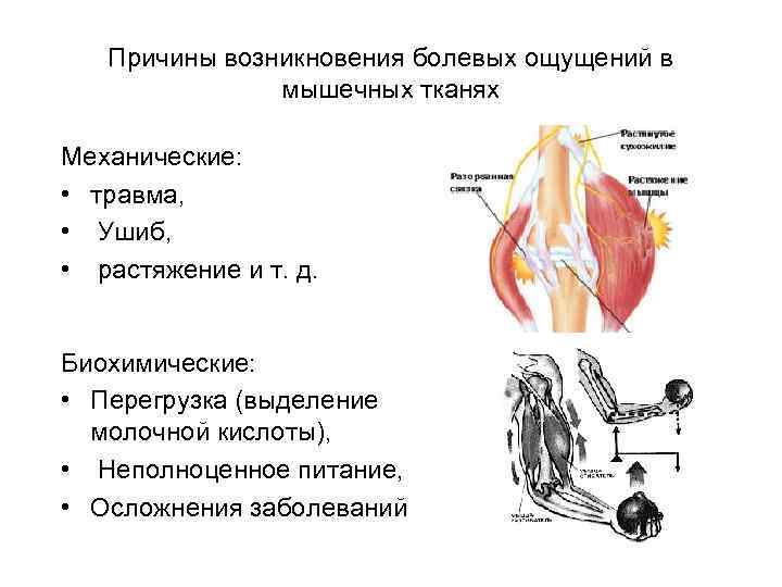 Нарушения мышц