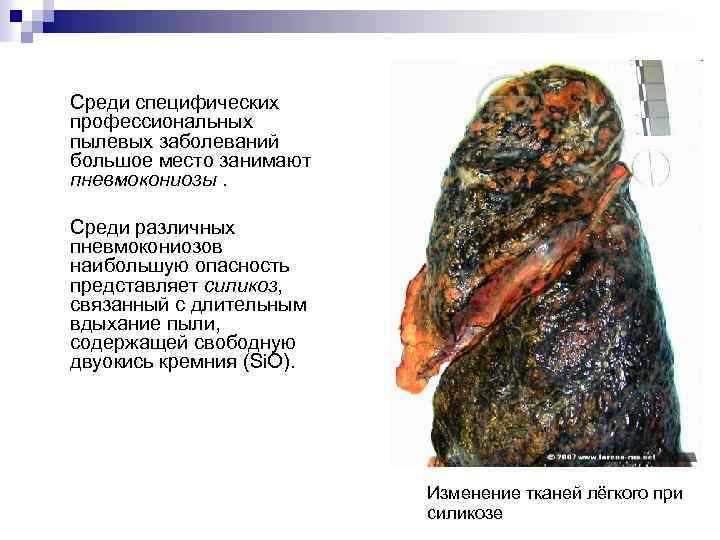 Среди специфических профессиональных пылевых заболеваний большое место занимают пневмокониозы. Среди различных пневмокониозов наибольшую опасность