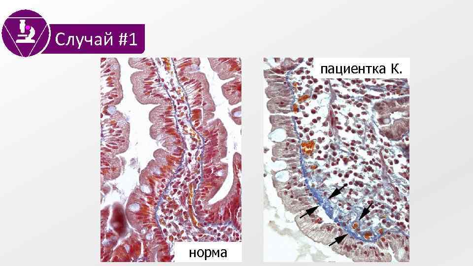Случай #1 пациентка К. норма 