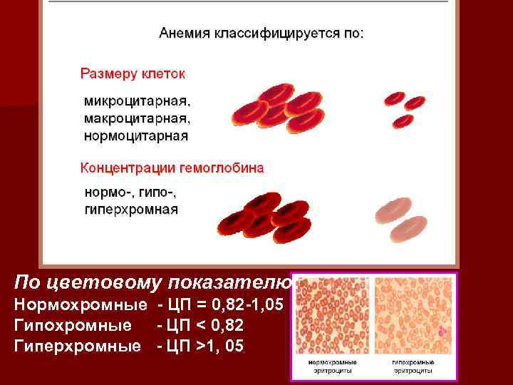 Гипохромная анемия степени. Гиперхромная анемия классификация. Цветовой показатель норма гиперхромная гипохромная. Цветовой показатель при гипохромной анемии и гиперхромной. Гиперхромная анемия цветовой показатель.