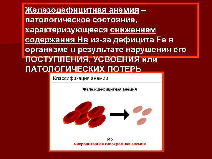 Железодефицитная анемия – патологическое состояние, характеризующееся снижением содержания Нв из-за дефицита Fe в организме