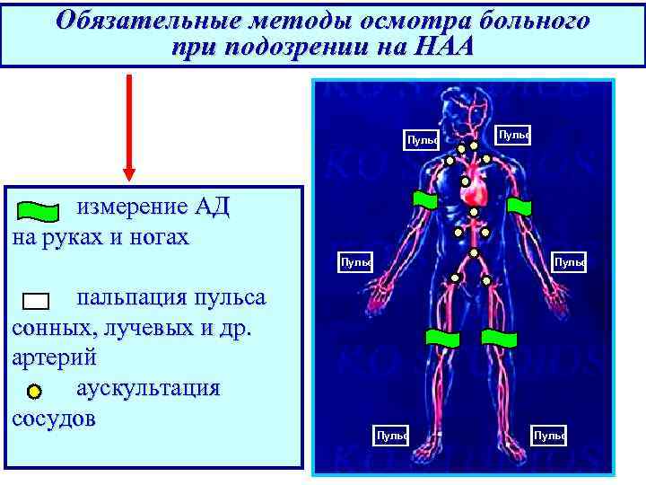 Обязательные методы осмотра больного при подозрении на НАА Пульс измерение АД на руках и