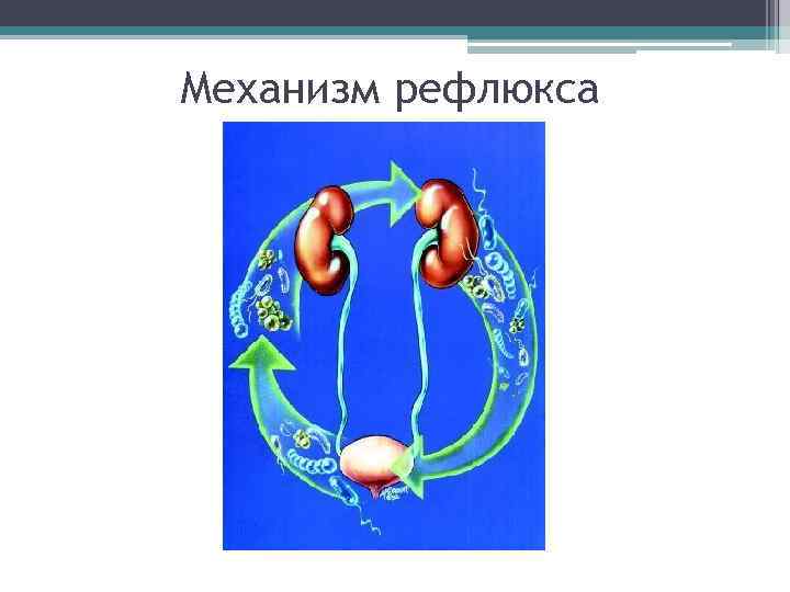 Механизм рефлюкса 