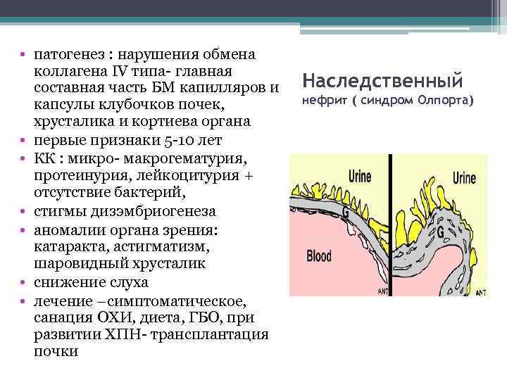  • патогенез : нарушения обмена коллагена IV типа- главная составная часть БМ капилляров