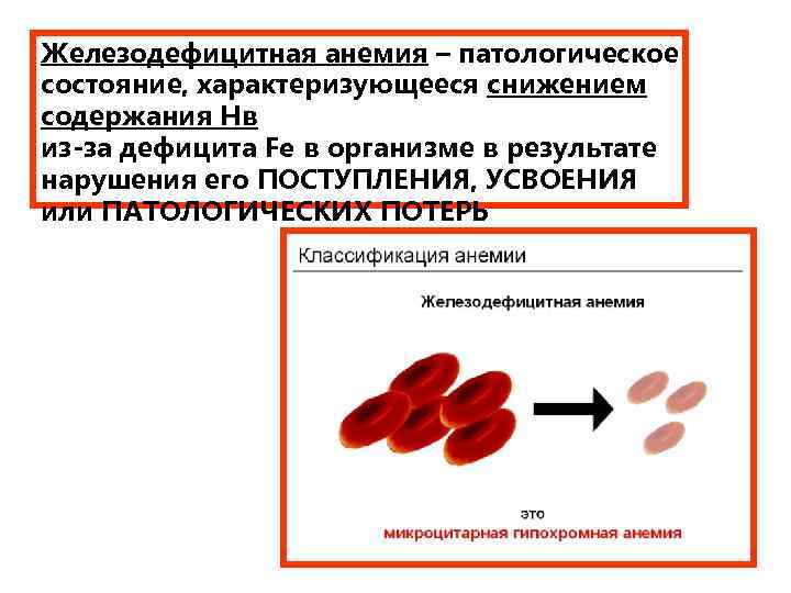 Железодефицитная анемия – патологическое состояние, характеризующееся снижением содержания Нв из-за дефицита Fe в организме