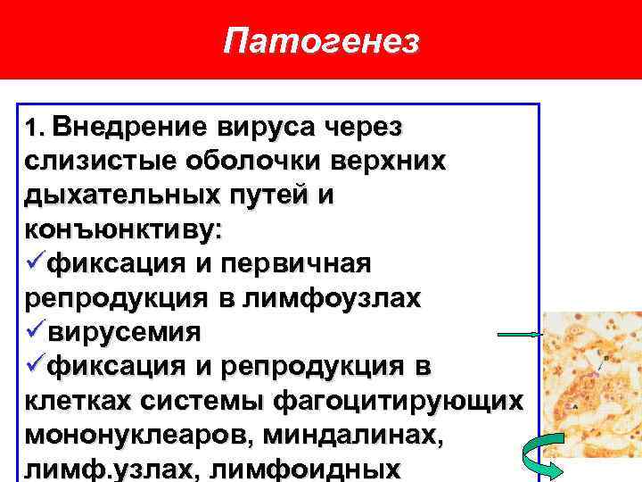 Патогенез 1. Внедрение вируса через слизистые оболочки верхних дыхательных путей и конъюнктиву: üфиксация и