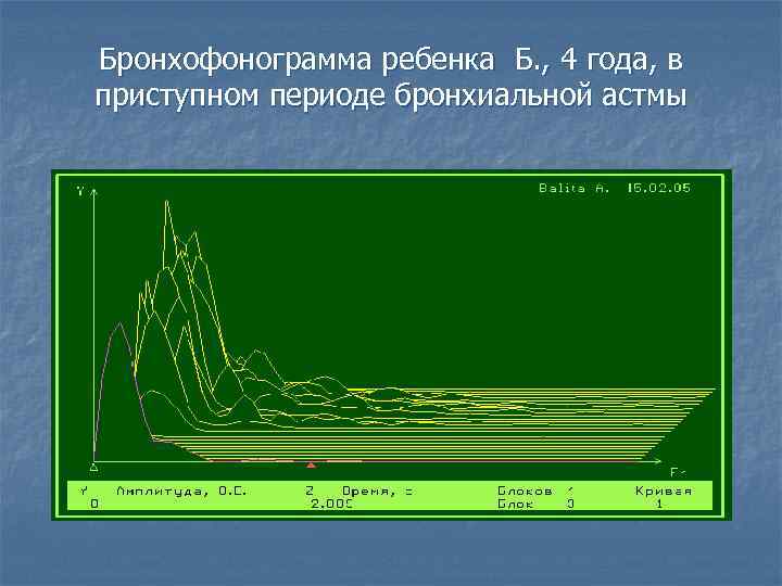 Бронхофонограмма ребенка Б. , 4 года, в приступном периоде бронхиальной астмы 