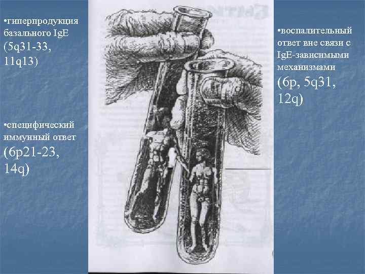 • гиперпродукция базального Ig. E (5 q 31 -33, 11 q 13) •