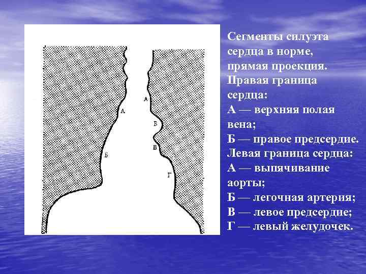 Сегменты силуэта сердца в норме, прямая проекция. Правая граница сердца: А — верхняя полая