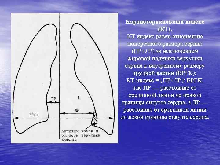 Кардиоторакальный индекс (КТ). КТ индекс равен отношению поперечного размера сердца (ПР+ЛР) за исключением жировой