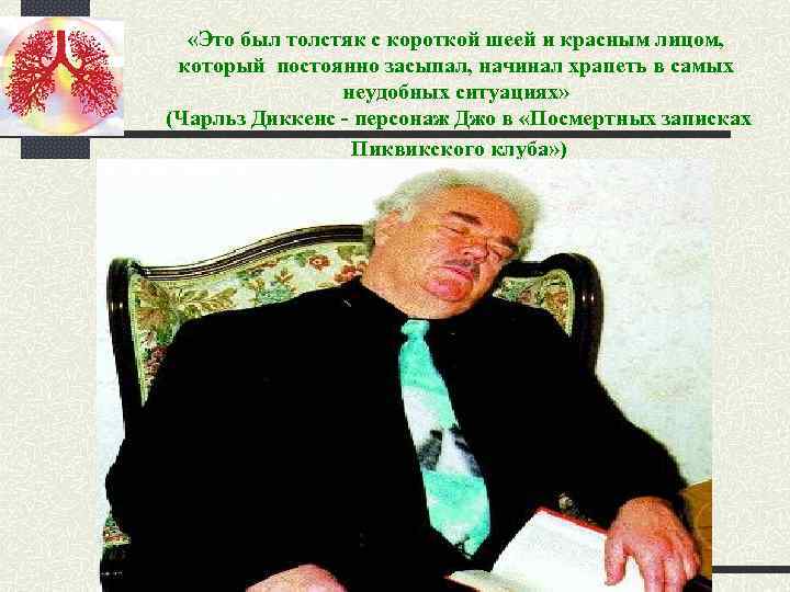  «Это был толстяк с короткой шеей и красным лицом, который постоянно засыпал, начинал