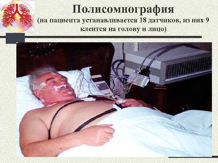 Полисомнография (на пациента устанавливается 18 датчиков, из них 9 клеится на голову и лицо)