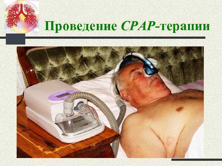 Проведение CPAP-терапии 
