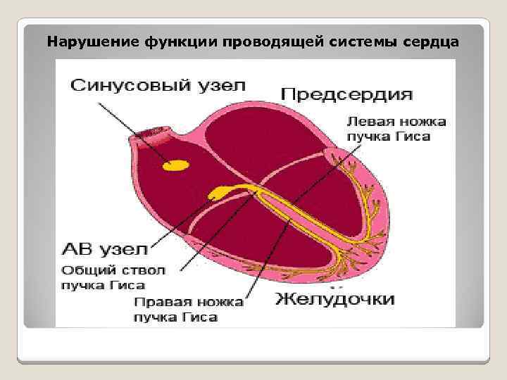 Нарушение функции проводящей системы сердца 