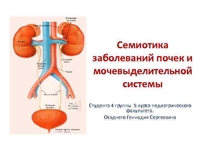 Заболевания мочевыделительной системы. Семиотика заболеваний мочевыводящих путей. Дубалостициальные заболевания мочевыделительной системы. Семиотика заболеваний почек и мочевыводящих путей. Семиотика заболеваний органов мочевыводящей системы..