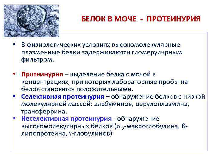 Белок в моче причины. Белок в моче. Белок в моче протеинурия. Наличие белка в моче называется.