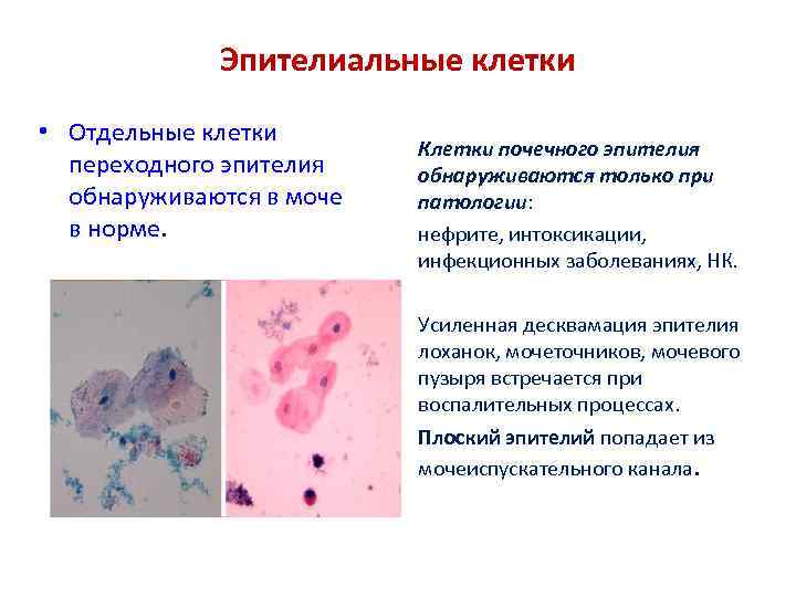 Эпителиальные клетки • Отдельные клетки переходного эпителия обнаруживаются в моче в норме. Клетки почечного