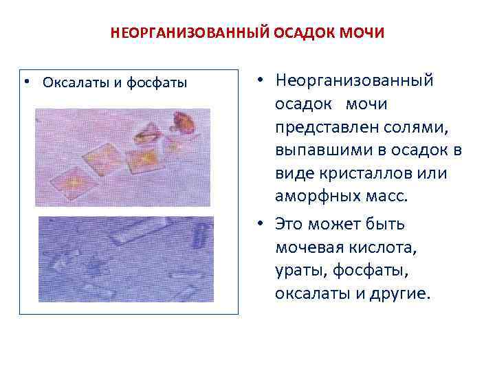 НЕОРГАНИЗОВАННЫЙ ОСАДОК МОЧИ • Оксалаты и фосфаты • Неорганизованный осадок мочи представлен солями, выпавшими