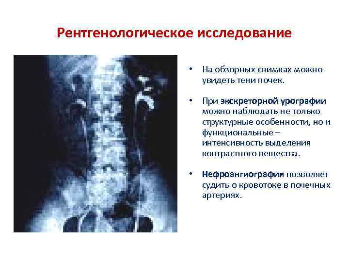 Рентгенологическое исследование • На обзорных снимках можно увидеть тени почек. • При экскреторной урографии