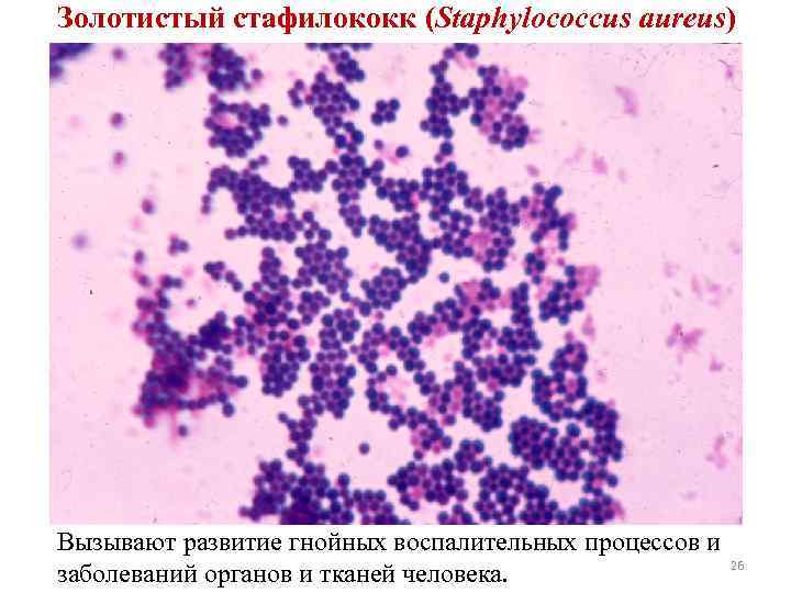 Золотистый стафилококк (Staphylococcus aureus) Вызывают развитие гнойных воспалительных процессов и заболеваний органов и тканей