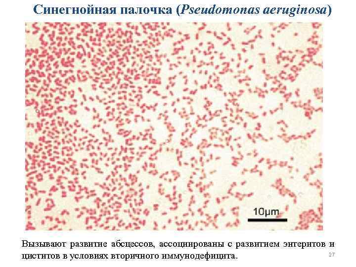 Синегнойная палочка (Pseudomonas aeruginosa) Вызывают развитие абсцессов, ассоциированы с развитием энтеритов и 27 циститов