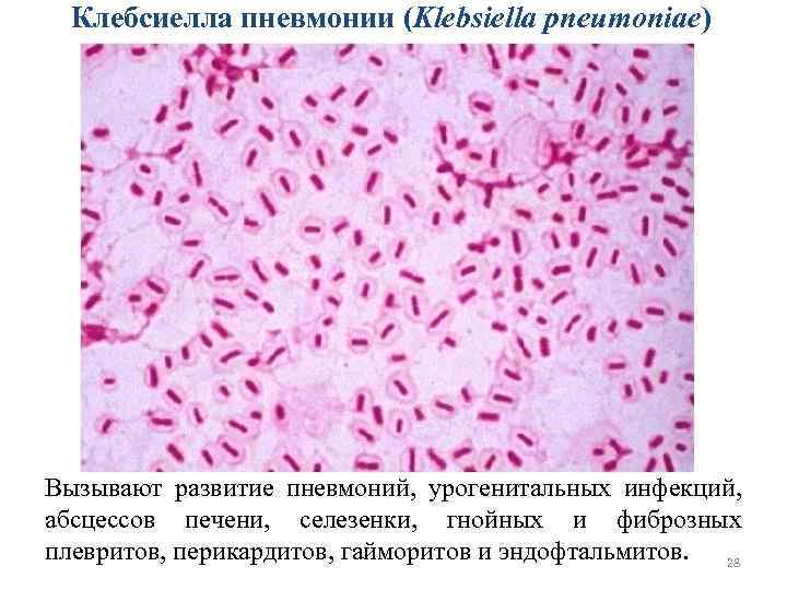 Клебсиелла пневмонии (Klebsiella pneumoniae) Вызывают развитие пневмоний, урогенитальных инфекций, абсцессов печени, селезенки, гнойных и