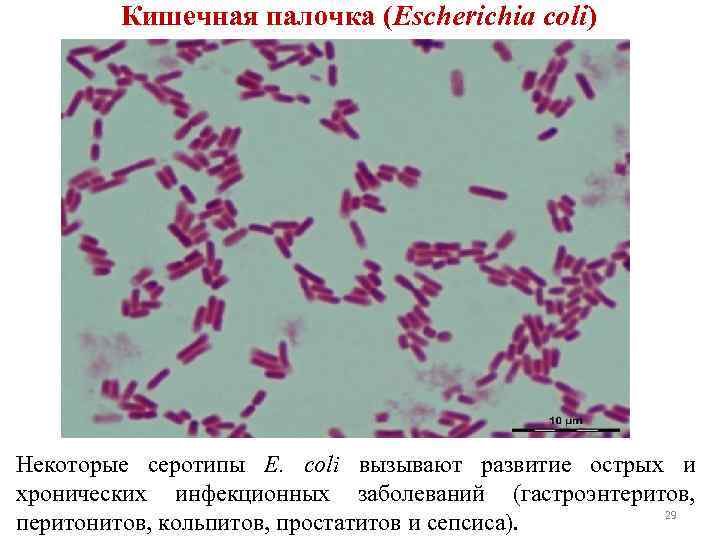 Кишечная палочка (Escherichia coli) Некоторые серотипы E. coli вызывают развитие острых и хронических инфекционных