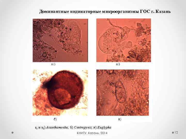 Доминантные индикаторные микроорганизмы ГОС г. Казань а 1 и а 2) Acanthamoeba; б) Centropyxis;