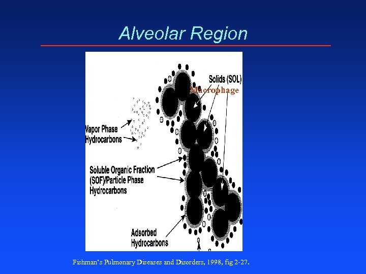 Alveolar Region Macrophage Fishman’s Pulmonary Diseases and Disorders, 1998, fig 2 -27. 