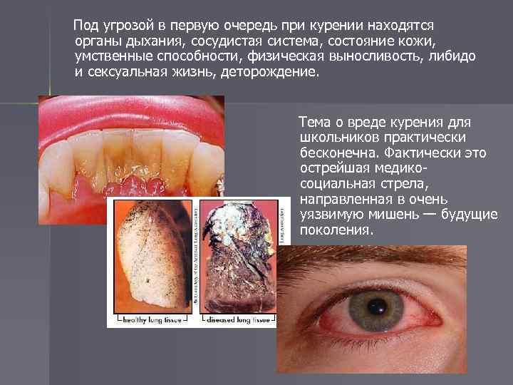 Под угрозой в первую очередь при курении находятся органы дыхания, сосудистая система, состояние кожи,