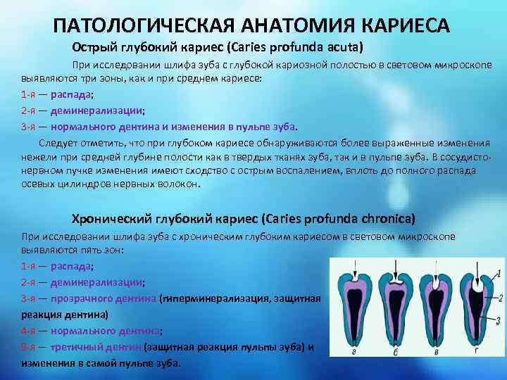 ПАТОЛОГИЧЕСКАЯ АНАТОМИЯ КАРИЕСА Острый глубокий кариес (Саries ргоfundа acuta) При исследовании шлифа зуба с