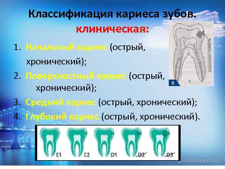 Классификация кариеса зубов. клиническая: 1. Начальный кариес (острый, хронический); 2. Поверхностный кариес (острый, хронический);