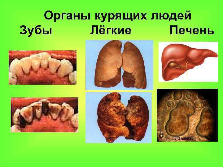 Органы курящих людей Зубы Лёгкие Печень 