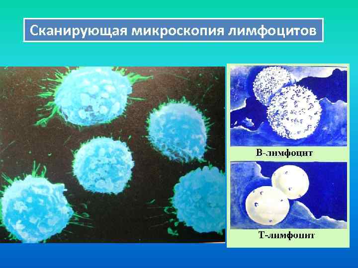 Сканирующая микроскопия лимфоцитов 