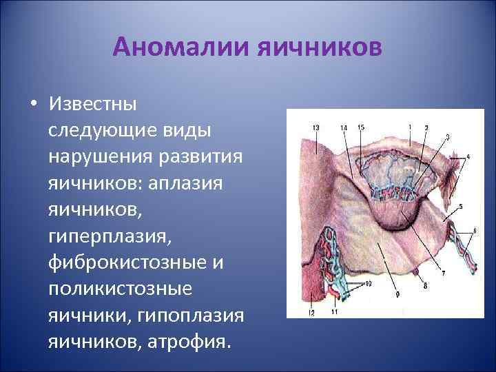 Аномалии яичников • Известны следующие виды нарушения развития яичников: аплазия яичников, гиперплазия, фиброкистозные и