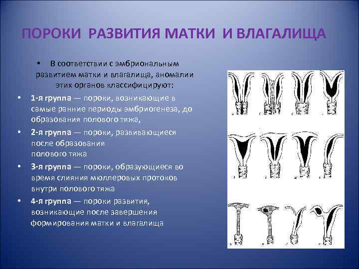 ПОРОКИ РАЗВИТИЯ МАТКИ И ВЛАГАЛИЩА • • • В соответствии с эмбриональным развитием матки