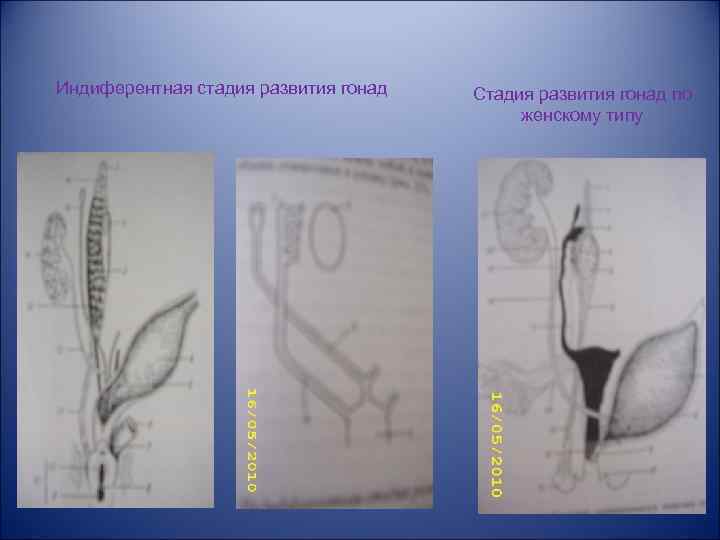 Индиферентная стадия развития гонад Стадия развития гонад по женскому типу 