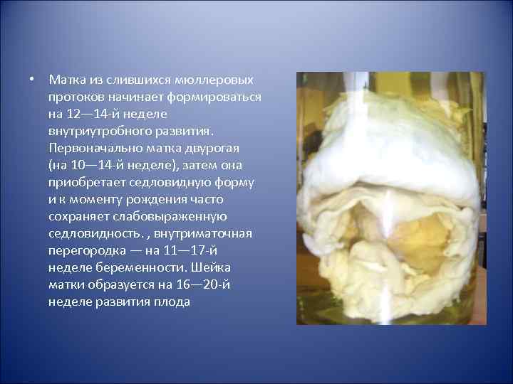  • Матка из слившихся мюллеровых протоков начинает формироваться на 12— 14 й неделе