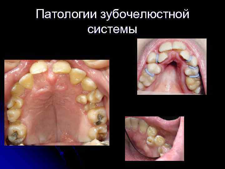 Патологии зубочелюстной системы 