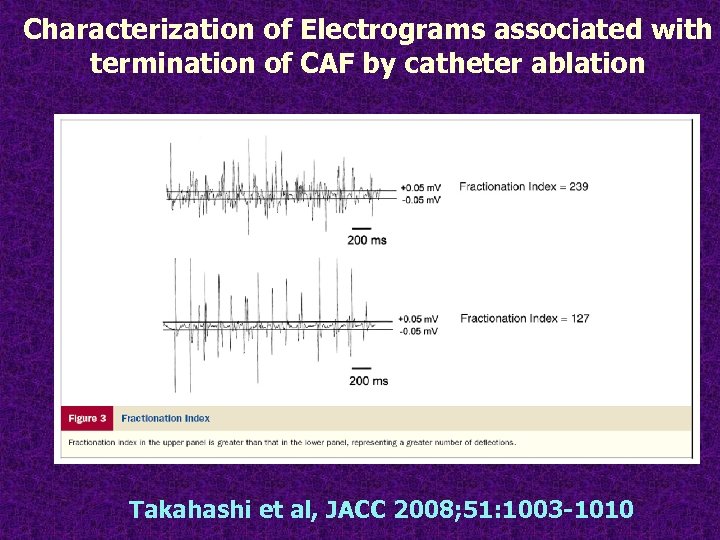 Characterization of Electrograms associated with termination of CAF by catheter ablation Takahashi et al,