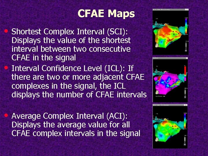 CFAE Maps • Shortest Complex Interval (SCI): • Displays the value of the shortest