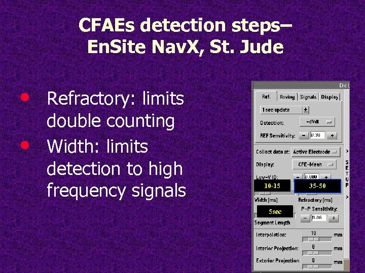 CFAEs detection steps– En. Site Nav. X, St. Jude • • Refractory: limits double