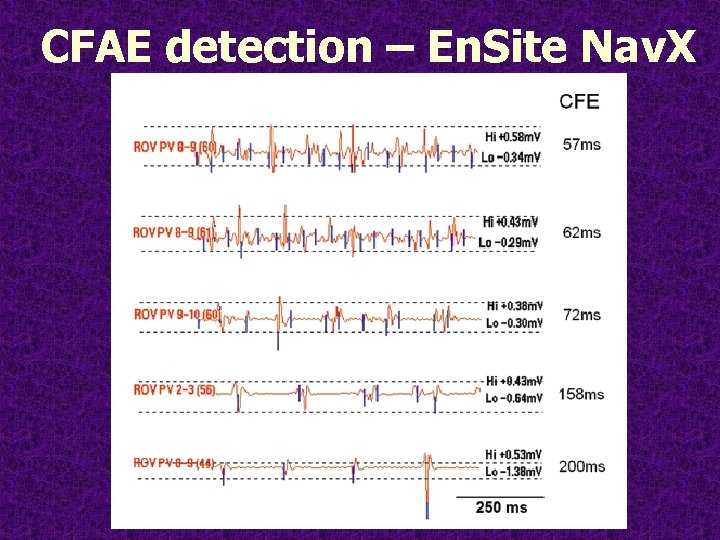 CFAE detection – En. Site Nav. X 