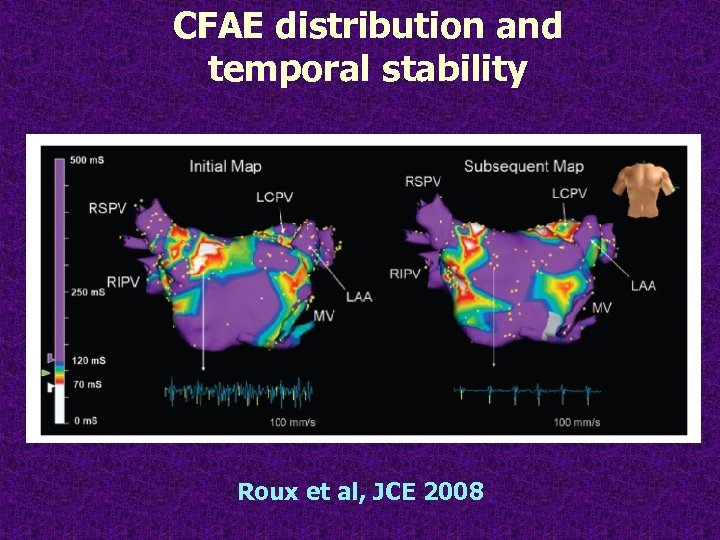 CFAE distribution and temporal stability Roux et al, JCE 2008 