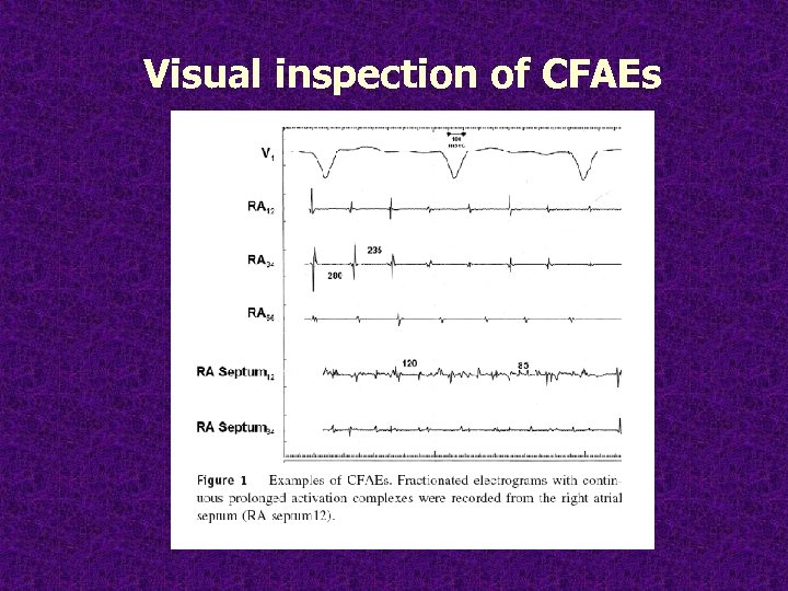 Visual inspection of CFAEs 