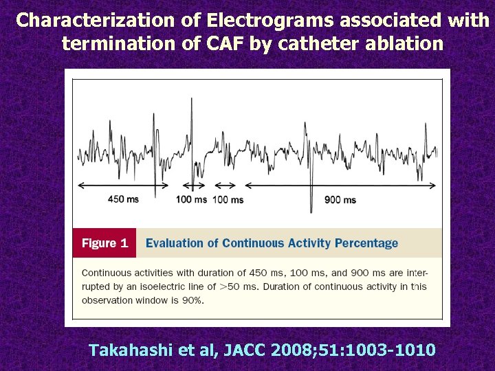 Characterization of Electrograms associated with termination of CAF by catheter ablation Takahashi et al,